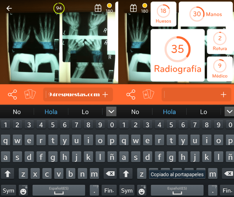 Imagen Radiografia 94 por ciento